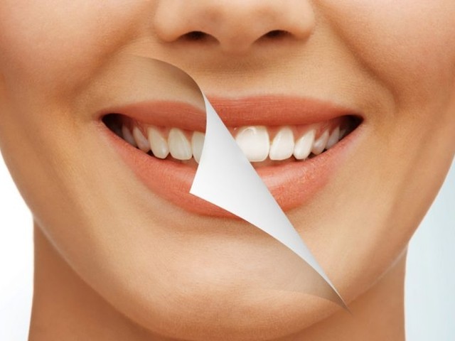 Что лучше Amazing white или Zoom: сравнение технологий отбеливания