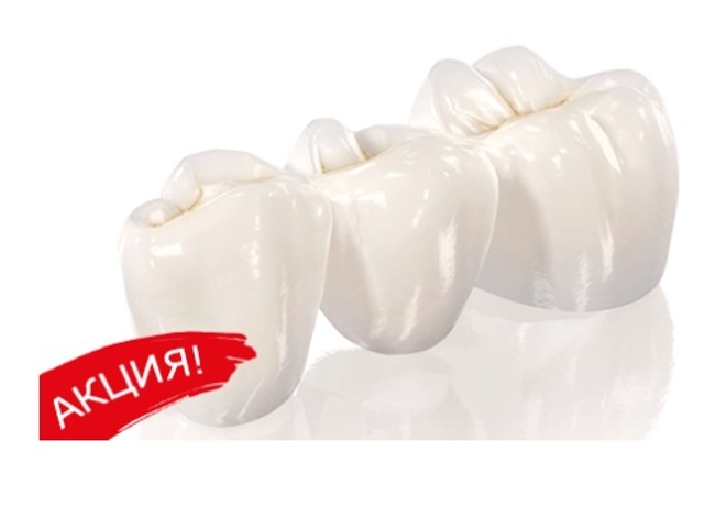 Циркониевая коронка акция москва