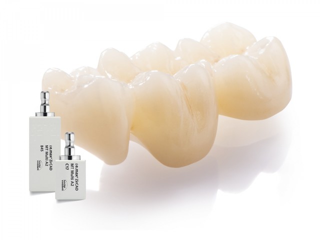 Коронка E-max (е-макс) или диоксид циркония: что выбрать?